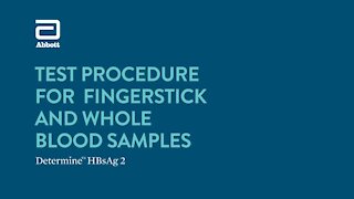 SOUTH AFRICA - Cape Town - Rapid diagnostic test for the detection of hepatitis B(Video) (yY8)