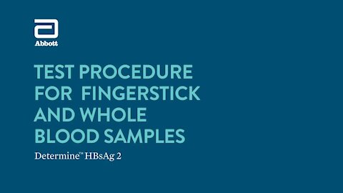 SOUTH AFRICA - Cape Town - Rapid diagnostic test for the detection of hepatitis B(Video) (yY8)