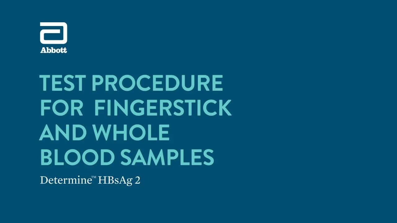 SOUTH AFRICA - Cape Town - Rapid diagnostic test for the detection of hepatitis B(Video) (yY8)