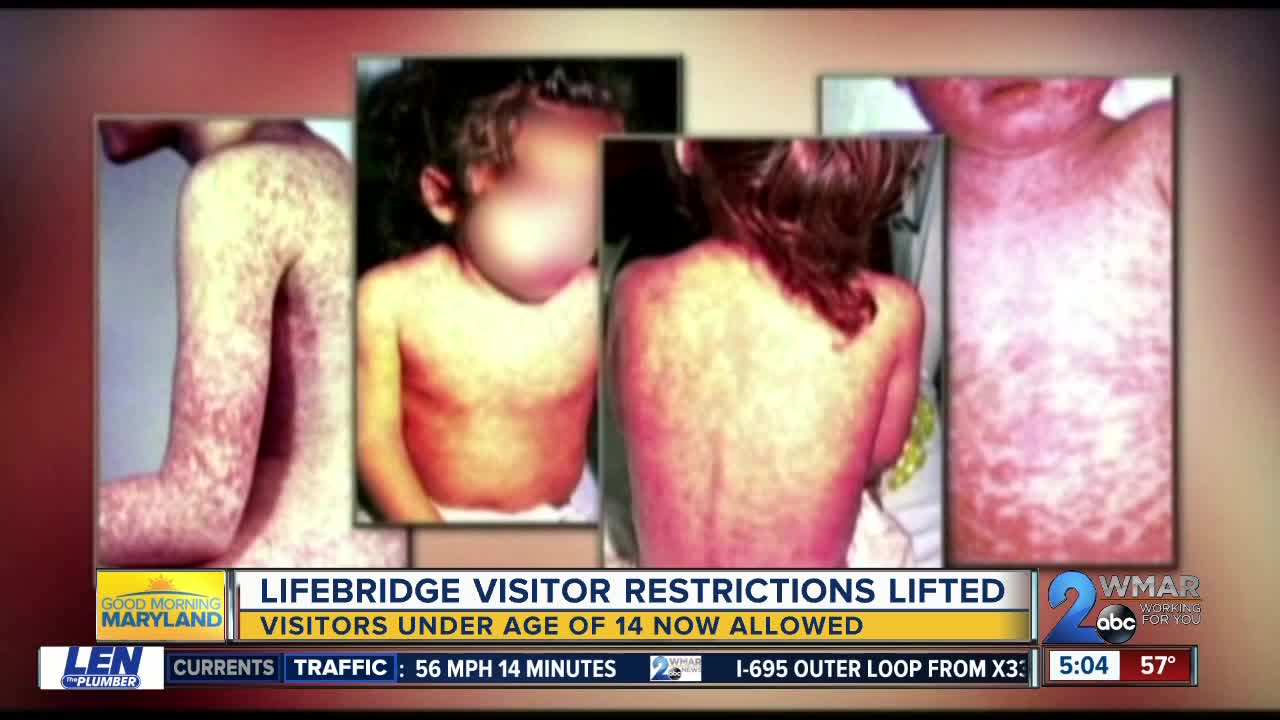 LifeBridge Health lifts ban on visitors under 14 y/o after reported measles cases in Pikesville