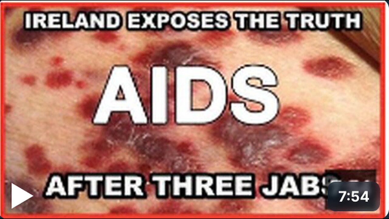 Ireland and other countries expose the truth that after THREE JABS, you will TEST POSITIVE for AIDS