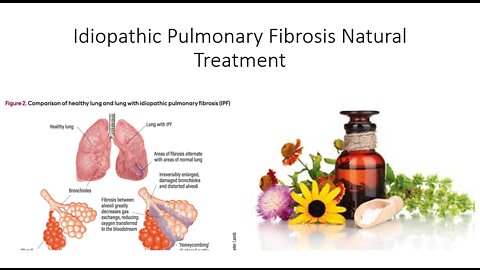 Idiopathic Pulmonary Fibrosis Natural Treatment