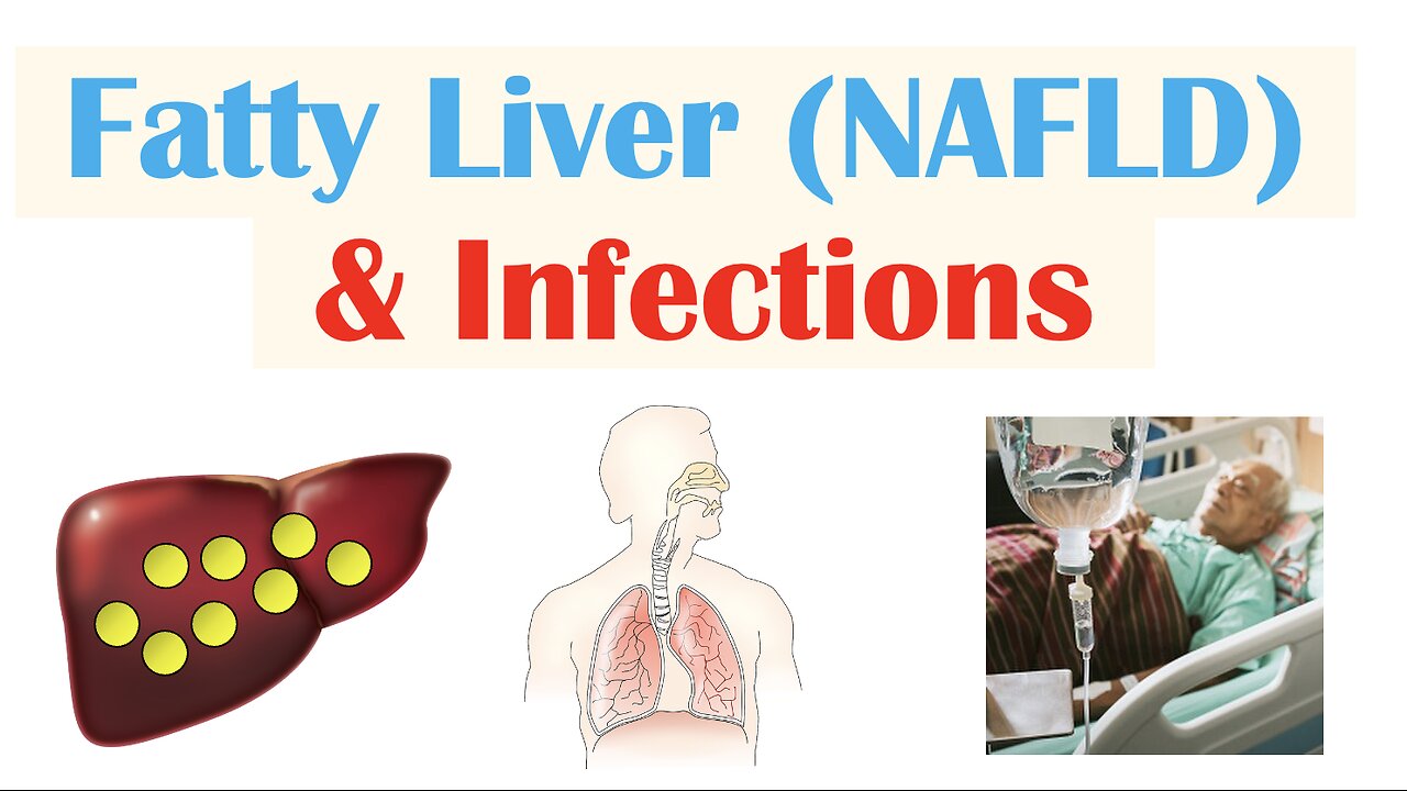 Non-Alcoholic Fatty Liver Disease & Infections | Immunity, Types of Infections