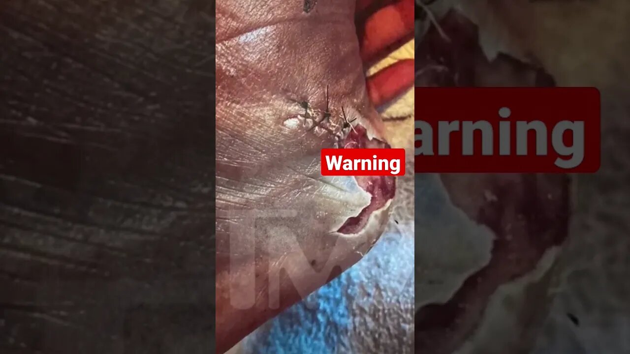 #Meg gunshot photo.. Full vid in description