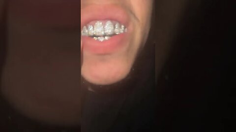 Konvy Buys New Grillz