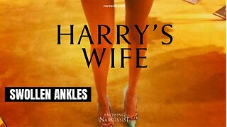 Swollen Ankles (Meghan Markle)