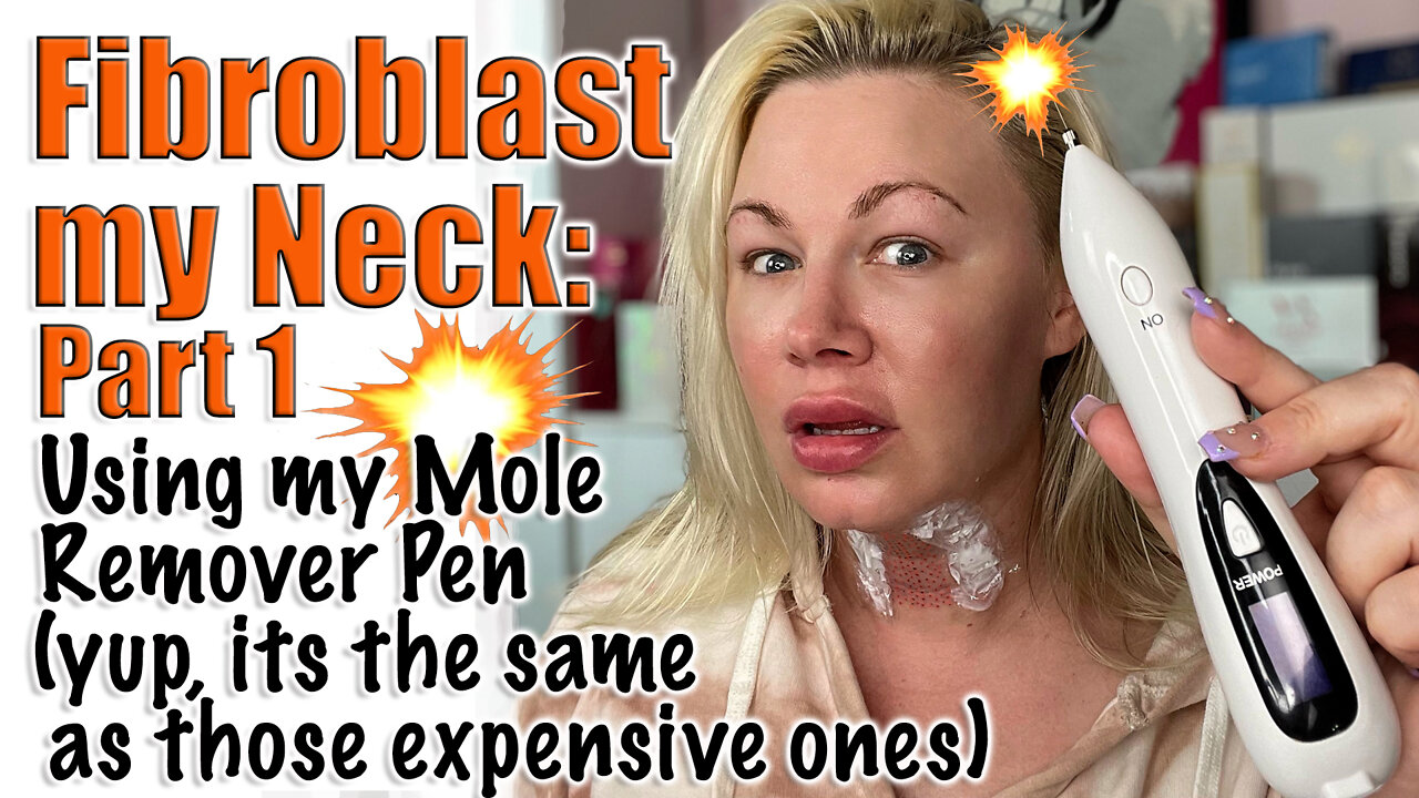 Fibroblast my Neck with Mole Pen : Part 1 | Code Jessica10 Saves you Money!