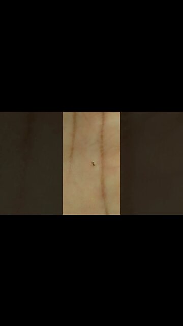 Abelha morre sempre após sua picada para defender sua colméia, isso porque seu intestino...#shorts