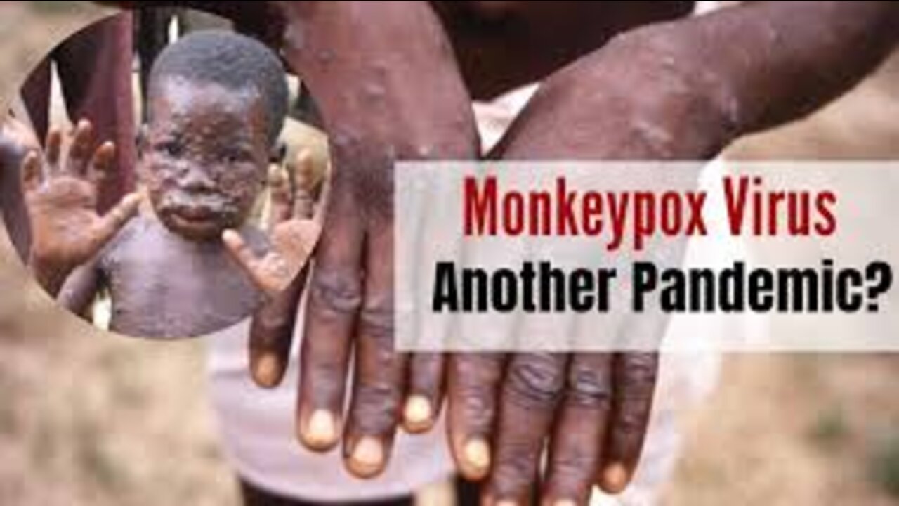 Monkeypox - how does it spread and what are the symptoms