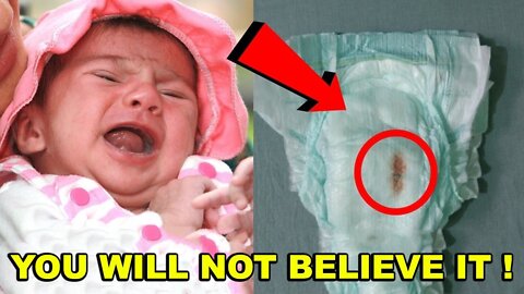 Her baby did not stop crying When she changed her diaper, she discovered something terrible