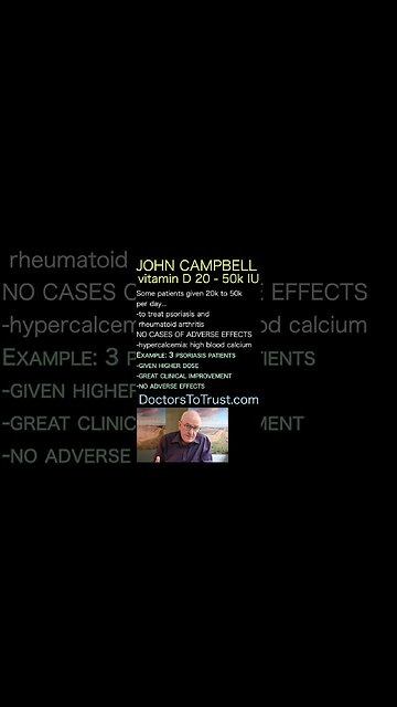 John Campbell. 20k to 50k D3 IU a day: no adverse response