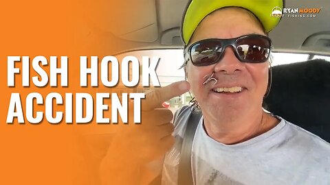 Fish hook accident after being startled by a crocodile