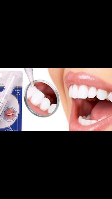 Dental Dazzling White Teeth Whitening Pen