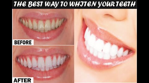 THE BEST WAY TO WHITEN YOUR TEETH