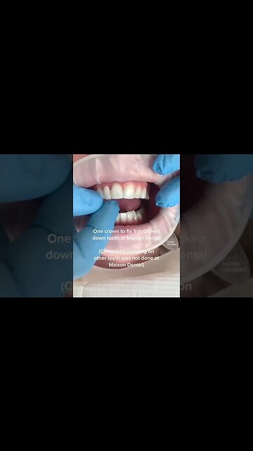 Dental And Teeth Hygiene