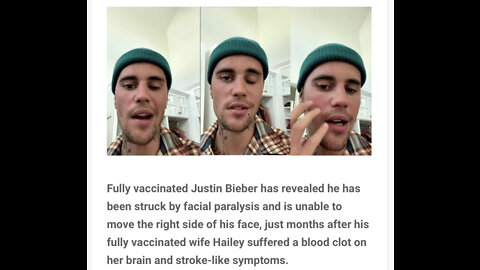 Bieber couple latest Hollywood victims of vax side effects