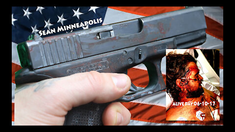 MEDIA COVERUP: I was attacked and shot antifa similar to Kyle Rittenhouse.