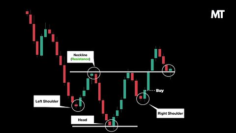 Inverse Head and Shoulders Chart Pattern | Part 1