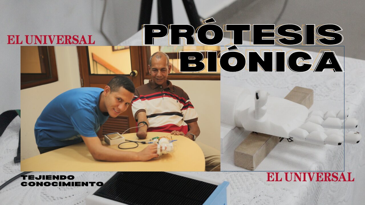 Las prótesis biónicas transforman vidas en Mompox