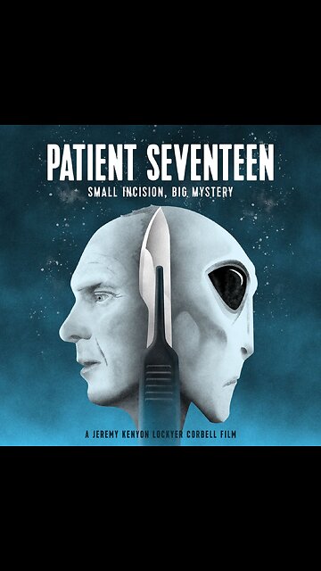 Patient 17 - Trailer