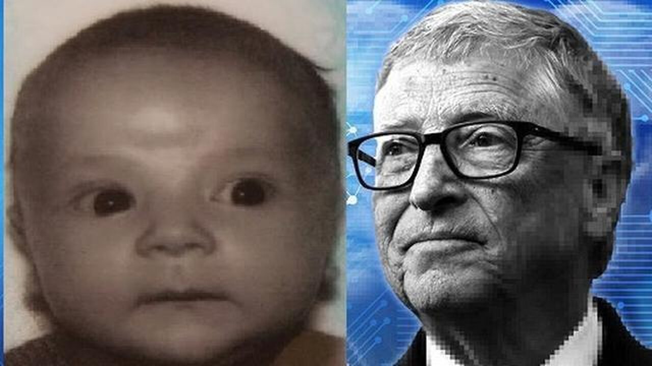 Bill Gates will be Implanting Digital ID in Newborn Baby’s in Kenya