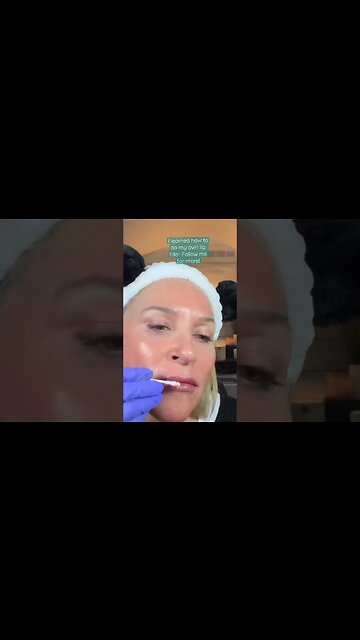 DIY LIP FILLER #shorts