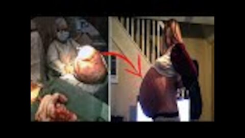 Pregnant woman’ Shocked By The Diagnosis Results Of What She Had In Her Belly