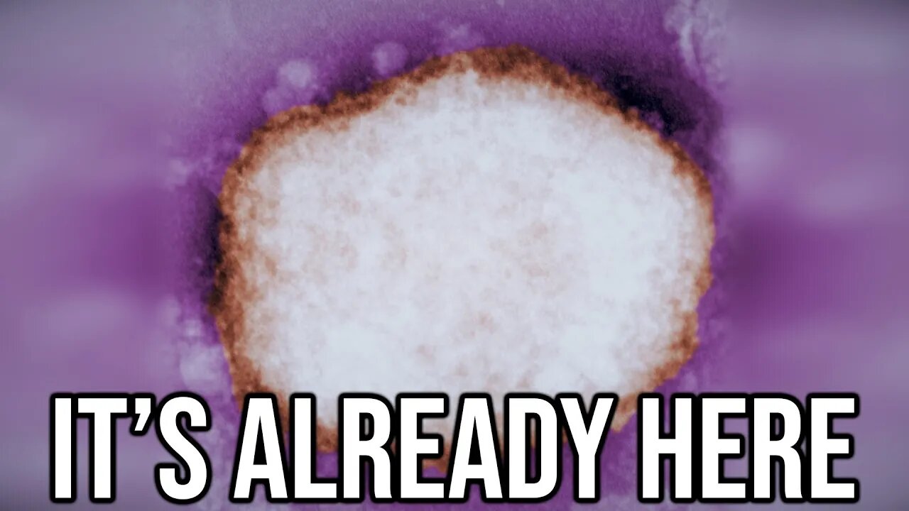 We Don't Need A Monkeypox Outbreak...