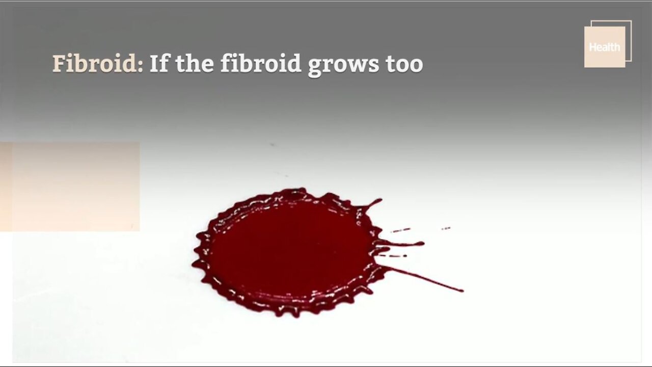 7 Reasons You're Bleeding After Intimate relationship, According to Ob-Gyns