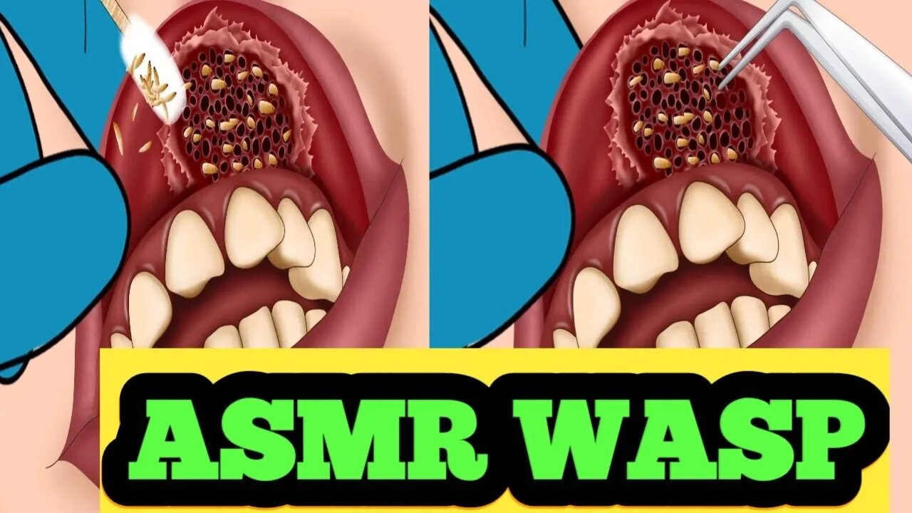 WASP Removal//Taking Care Of Dead Skin Call On Your Lips// ASMR Animations//@uttam6361