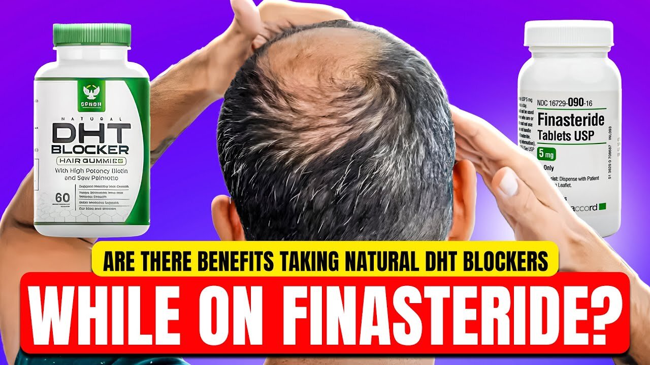 Combining Natural DHT Blocker Supplements With Finasteride