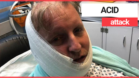 Acid attack victim was asked to pay for water after he begged for help