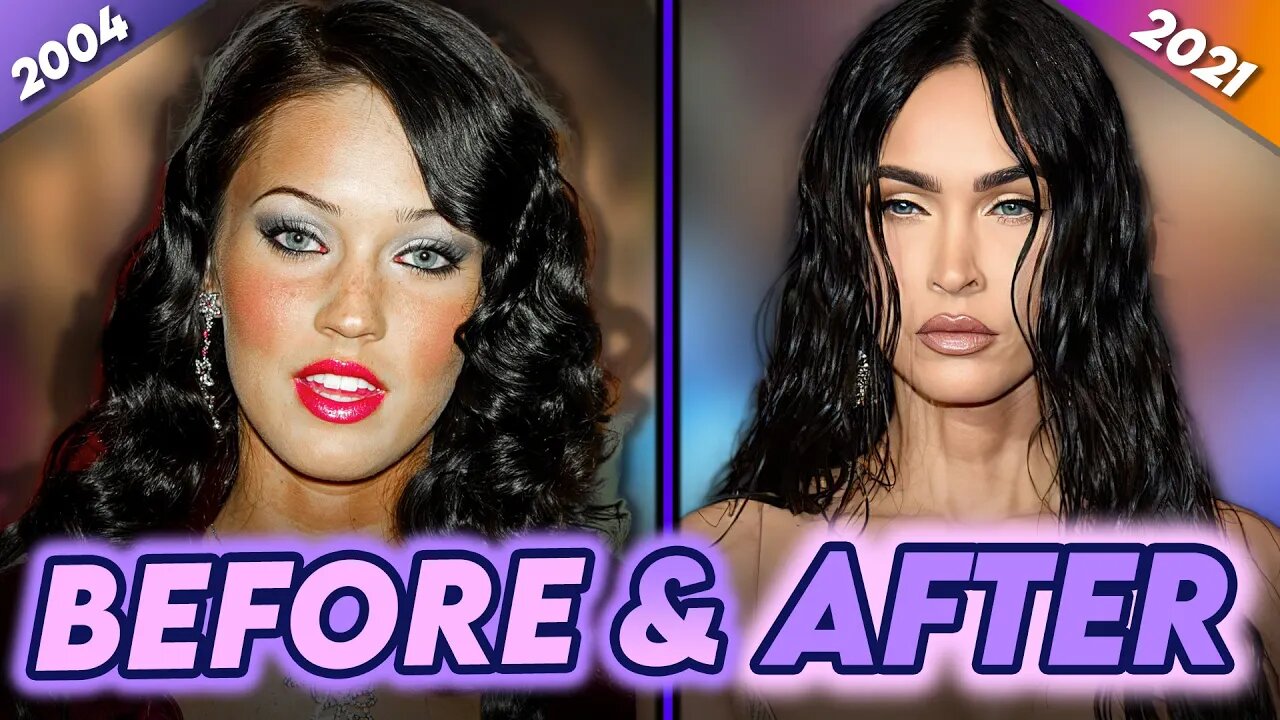 Megan Fox | Before & After | Plastic Surgery, Botox & MGK Punk Effect