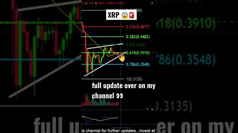 XRP potential 18%drop🚨💎🙌