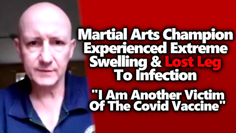 "I Am Another Victim," English Martial Arts Champ Leg Had To Be Amputated After AZ Vax