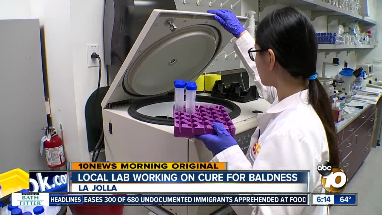 La Jolla lab working on cure for baldness