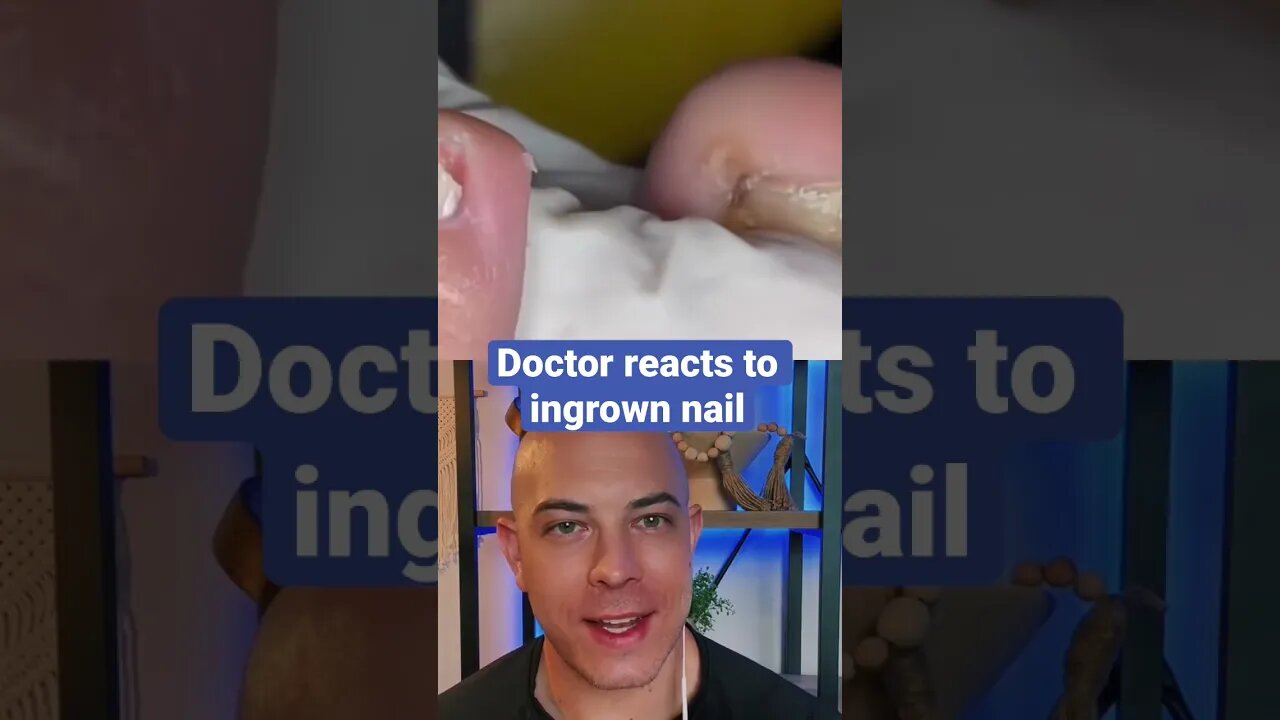Doctor reacts to gnarly ingrown nail!