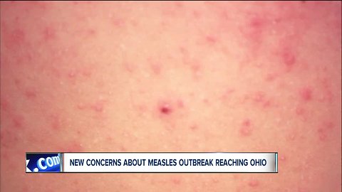 Holiday travel could potentially bring measles outbreak to Ohio