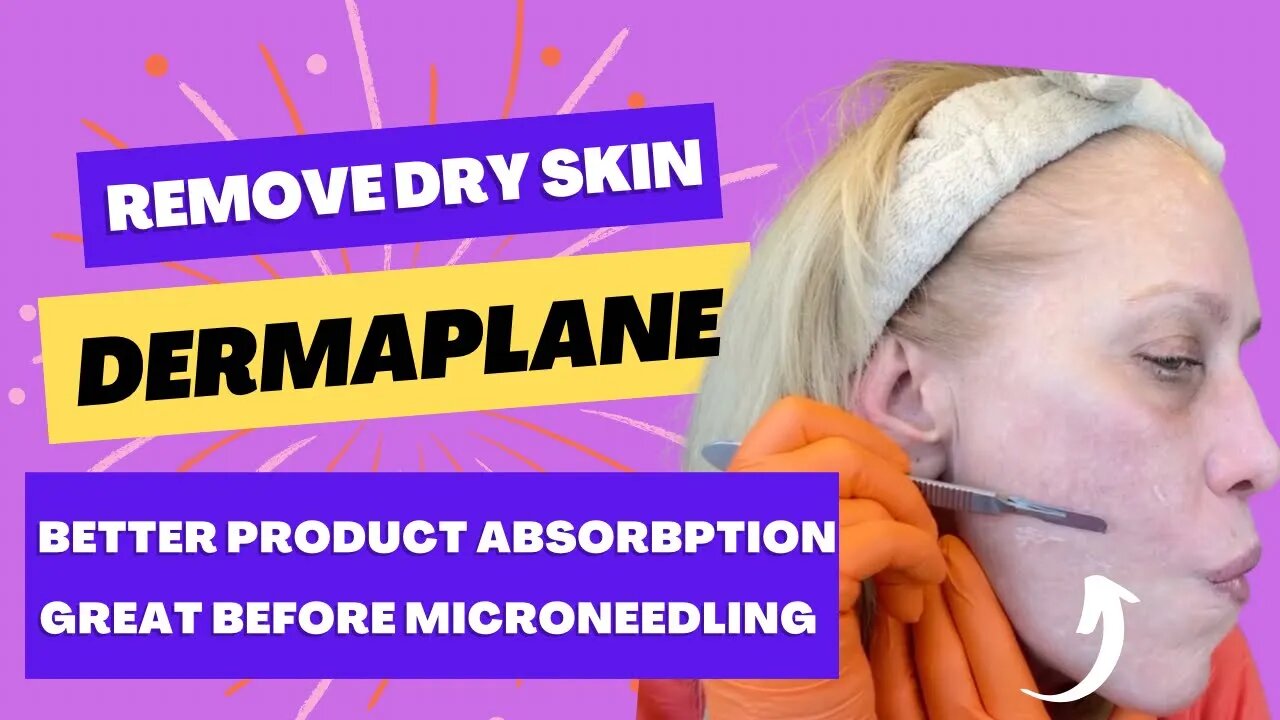 Dermaplane to Remove Dry Skin - Great Before Microneedling