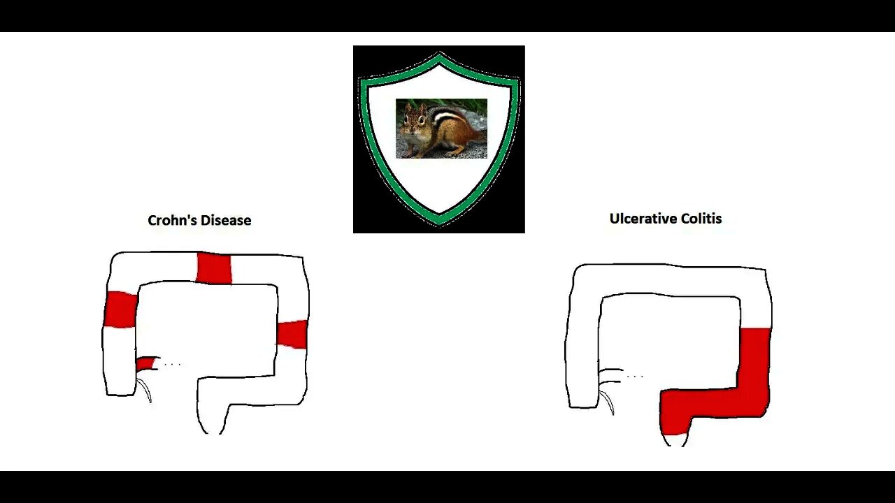 Crohn's Disease VS Ulcerative Colitis explained by a chipmunk