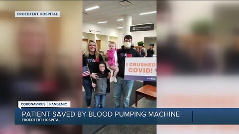 27-year-old Wisconsin man critically ill with COVID-19 saved thanks to blood pumping machine