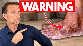 Your Feet Give You WARNING Signs of Underlying Diseases