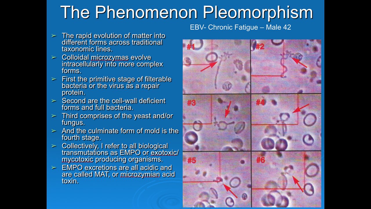 The Validation of Biological Transformation or Pleomorphism of the Red Blood Cell Into Bacteria