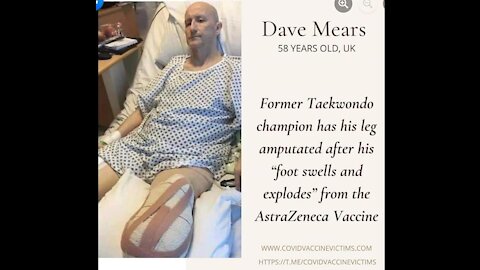 Man Foot Explodes After Receiving the Jab!