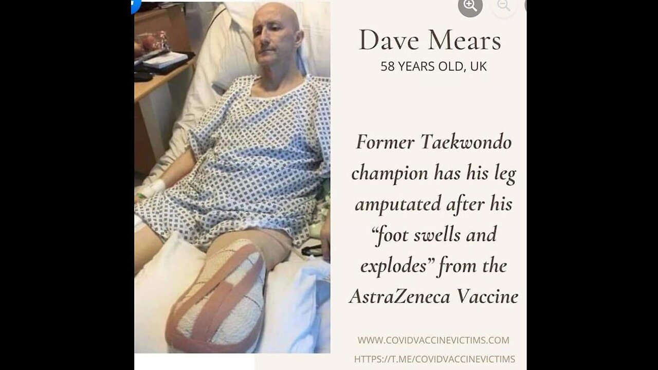 Man Foot Explodes After Receiving the Jab!