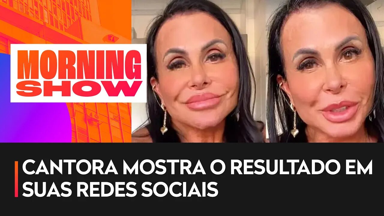 Gretchen faz novos procedimentos no rosto e bumbum