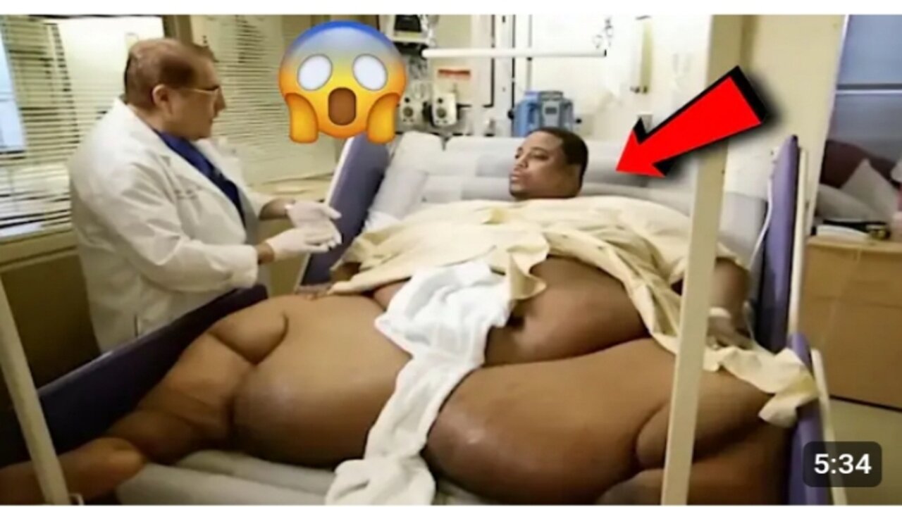 Dr. Now Gets FURIOUS at This 735-Lb Man | My 600-lb Life