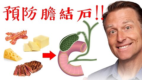 預防膽結石,要多吃脂肪,降低膽固醇吃膽鹽,自然療法,柏格醫生 Dr Berg