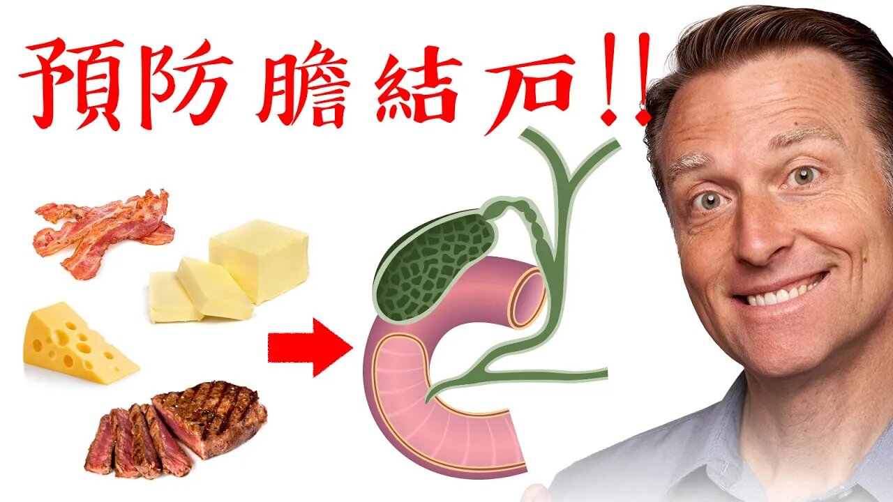 預防膽結石,要多吃脂肪,降低膽固醇吃膽鹽,自然療法,柏格醫生 Dr Berg