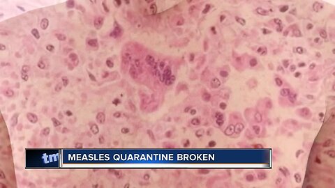 Brookfield man charged with breaking measles quarantine faces judge Monday